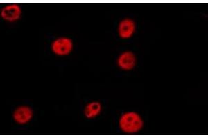 ABIN6277199 staining HepG2 by IF/ICC. (Histone 3 antibody  (H3K27me2))