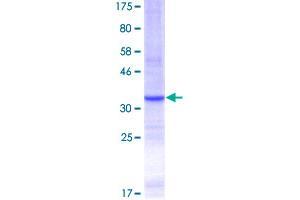 TLR4 Protein (AA 214-291) (GST tag)