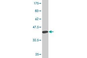 Western Blot detection against Immunogen (37. (ARHGAP6 antibody  (AA 531-636))