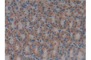 Used in DAB staining on fromalin fixed paraffin- embedded kidney tissue (HMGB1 antibody  (AA 1-215))