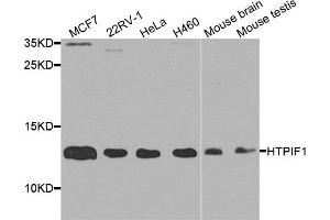 Western blot analysis of extract of various cells, using ATPIF1 antibody. (ATPase Inhibitory Factor 1 antibody)