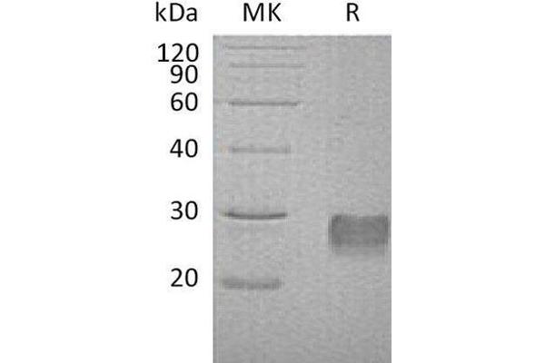 IGFBP6 Protein (His tag)