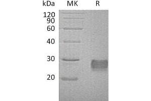 Western Blotting (WB) image for Insulin-Like Growth Factor Binding Protein 6 (IGFBP6) protein (His tag) (ABIN7320547) (IGFBP6 Protein (His tag))