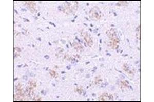 Immunohistochemistry of KLHL1 in rat brain tissue with this product at 10 μg/ml. (KLHL1 antibody  (N-Term))