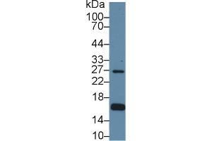 Detection of AQP2 in Human Hela cell lysate using Polyclonal Antibody to Aquaporin 2, Collecting Duct (AQP2) (AQP2 antibody  (AA 177-271))