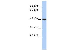 GLRX3 antibody used at 1 ug/ml to detect target protein.