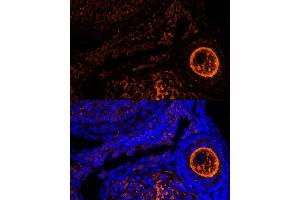 Immunofluorescence analysis of mouse oophoroma cells using ZP2 antibody (ABIN6128965, ABIN6150534, ABIN6150535 and ABIN6214263) at dilution of 1:100. (ZP2 antibody  (AA 651-745))