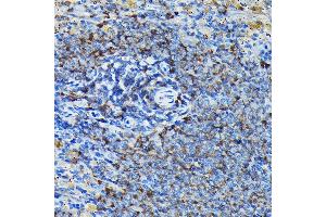 Immunohistochemistry of paraffin-embedded mouse spleen using RPL23A Rabbit pAb (ABIN1682576, ABIN3018519, ABIN3018520 and ABIN6220494) at dilution of 1:100 (40x lens). (RPL23A antibody  (AA 1-156))
