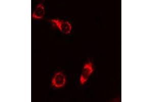 ABIN6267680 staining 293 cells by IF/ICC. (BAD antibody  (pSer155))