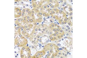 Immunohistochemistry of paraffin-embedded mouse kidney using CCDC124 antibody  at dilution of 1:100 (40x lens). (CCDC124 antibody  (AA 1-223))