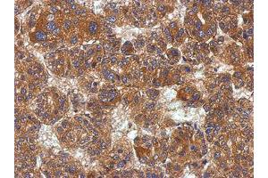 Image no. 1 for anti-Potassium Channel Tetramerisation Domain Containing 19 (KCTD19) (AA 1-162) antibody (ABIN1501897) (KCTD19 antibody  (AA 1-162))
