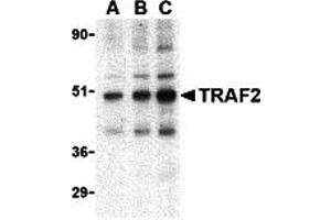 Western Blotting (WB) image for anti-TNF Receptor-Associated Factor 2 (TRAF2) (C-Term) antibody (ABIN1030764) (TRAF2 antibody  (C-Term))