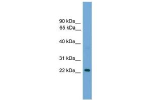 WB Suggested Anti-RAB39 Antibody Titration: 0.