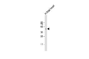 Anti-ZDHHC18 Antibody (C-Term) at 1:1000 dilution + human fetal heart lysate Lysates/proteins at 20 μg per lane. (ZDHHC18 antibody  (AA 331-361))
