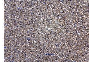 IHC analysis of Hexokinase 1/HK1 using anti-Hexokinase 1/HK1 antibody (ABIN7600260). (Hexokinase 1 antibody  (AA 17-323))