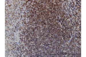 Immunoperoxidase of monoclonal antibody to EPHB3 on formalin-fixed paraffin-embedded human tonsil.