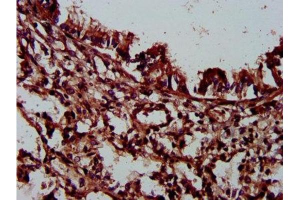 PLEC antibody  (AA 1744-1929)
