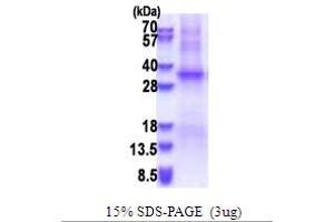 SDS-PAGE (SDS) image for Testis-Specific Serine Kinase 6 (TSSK6) (AA 1-273) protein (His tag) (ABIN5853645) (TSSK6 Protein (AA 1-273) (His tag))