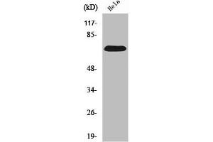 Western Blot analysis of HepG2 cells using SDHA Polyclonal Antibody (SDHA antibody  (C-Term))