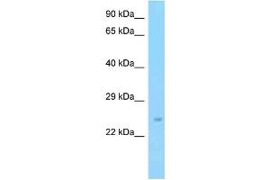 Western Blotting (WB) image for anti-Solute Carrier Family 9 (Sodium/hydrogen Exchanger), Member 3 Regulator 2 (SLC9A3R2) (C-Term) antibody (ABIN2781613)