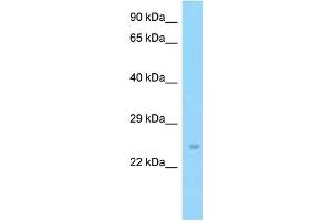 WB Suggested Anti-Slc9a3r2 Antibody Titration: 1. (SLC9A3R2 antibody  (C-Term))
