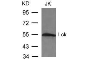Western blot analysis of extracts from JK cells using Lck(Ab-394) Antibody. (LCK antibody  (AA 392-396))