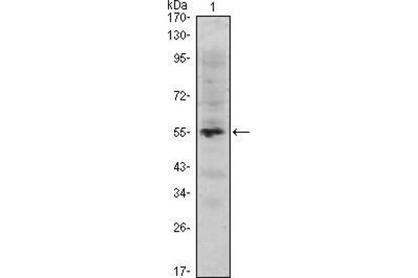 MUM1 antibody