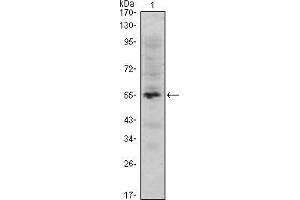 Western blot analysis using MUM1 mAb against human MUM1 (AA: 590-711) recombinant protein.