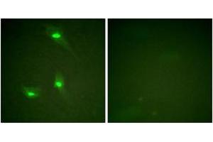 Immunofluorescence analysis of HeLa cells, using GTPase Activating Protein (Phospho-Ser387) Antibody. (RACGAP1 antibody  (pSer387))