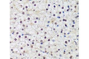 Immunohistochemistry of paraffin-embedded Human liver using DNMT1 Polyclonal Antibody at dilution of 1:200 (40x lens). (DNMT1 antibody)