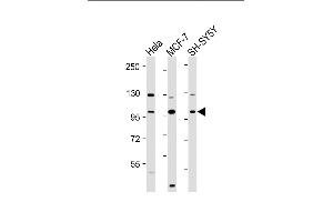 All lanes : Anti-VAV2 Antibody (N-Term) at 1:2000 dilution Lane 1: Hela whole cell lysate Lane 2: MCF-7 whole cell lysate Lane 3: SH-SY5Y whole cell lysate Lysates/proteins at 20 μg per lane. (VAV2 antibody)