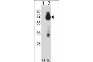 Western Blotting (WB) image for anti-Baculoviral IAP Repeat Containing 3 (BIRC3) (AA 59-88), (N-Term) antibody (ABIN657941)
