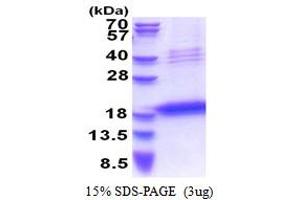 SDS-PAGE (SDS) image for Leukocyte Cell Derived Chemotaxin 1 (LECT1) (AA 214-334) protein (His tag) (ABIN5853498)
