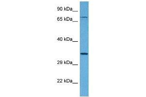 Host:  Rabbit  Target Name:  TSPAN5  Sample Tissue:  Human 293T Whole Cell  Antibody Dilution:  1ug/ml (Tetraspanin 5 antibody  (Middle Region))