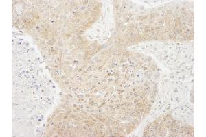 anti-CREB Regulated Transcription Coactivator 1 (CRTC1) (C-Term) antibody