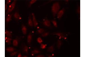 Immunofluorescence analysis of U2OS cells using PCCB antibody (ABIN5973142). (PCCB antibody)