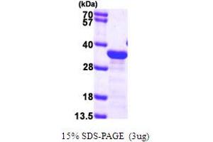 MAPRE1 Protein (AA 1-268) (His tag)