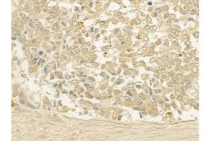 ABIN6257620 and ABIN6275306 at 1/100 staining human normal gastric tissue by IHC-P.