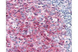 Anti-PAG1 / PAG antibody IHC of human tonsil. (PAG1 antibody  (AA 97-432))