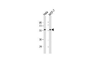All lanes : Anti-TIGD1 Antibody (N-term) at 1:1000 dilution Lane 1: Hela whole cell lysate Lane 2: MCF-7 whole cell lysate Lysates/proteins at 20 μg per lane. (TIGD1 antibody  (N-Term))