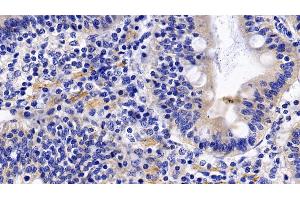 Immunohistochemistry (IHC) image for anti-Tumor Necrosis Factor Receptor Superfamily, Member 1A (TNFRSF1A) (AA 248-428) antibody (ABIN7442288)