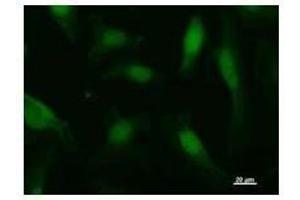 Immunostaining analysis in HeLa cells. (AHNAK antibody)