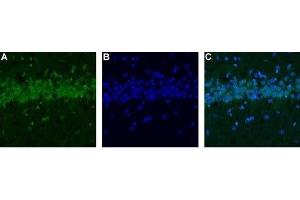 Expression of CALHM1 in rat hippocampus - Immunohistochemical staining of rat hippocampus using Anti-CALHM1 Antibody (ABIN7043013, ABIN7044044 and ABIN7044045). (CALHM1 antibody  (C-Term, Intracellular))