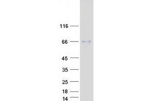 Validation with Western Blot