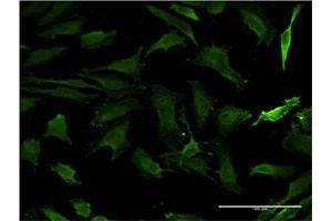Immunofluorescence of monoclonal antibody to HTT on HeLa cell. (Huntingtin antibody  (AA 1524-1627))