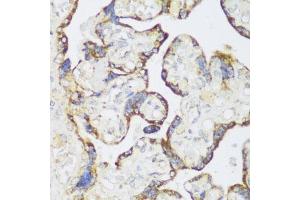 Immunohistochemistry of paraffin-embedded human placenta using ECH1 antibody  at dilution of 1:150 (40x lens). (ECH1 antibody  (AA 1-328))