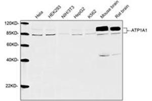 Western blot analysis of cell and tissue lysates using 1 µg/mL Rabbit Anti-ATP1A1 Polyclonal Antibody (ABIN398982) The signal was developed with IRDyeTM 800 Conjugated Goat Anti-Rabbit IgG. (ATP1A1 antibody  (AA 800-850))
