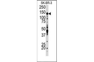 Western blot analysis of anti-IGF1R Antibody (N-term) in SK-BR-3 cell line lysates (35ug/lane).
