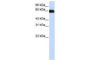 ADAM12 antibody used at 1 ug/ml to detect target protein. (ADAM12 antibody)