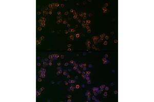 Immunofluorescence analysis of Jurkat cells using CD99 Rabbit pAb (ABIN3022730, ABIN3022731, ABIN3022732, ABIN1512728 and ABIN6219199) at dilution of 1:25 (40x lens). (CD99 antibody  (AA 23-185))